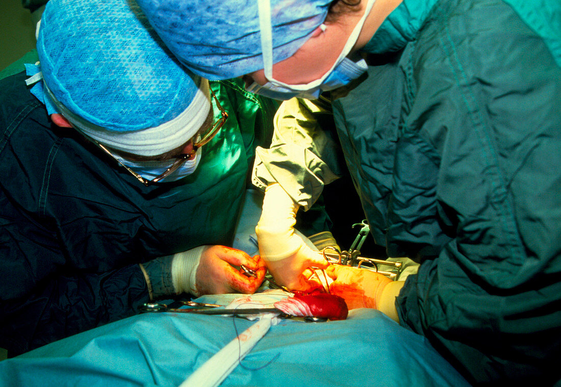 Surgeons performing a pelvic floor repair