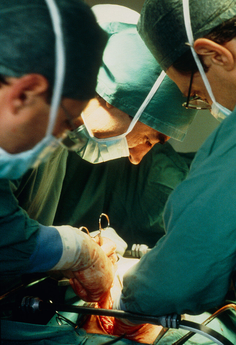 View of surgical team during an operation