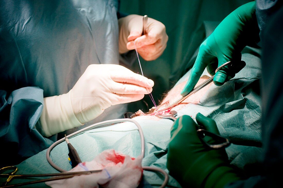 Hernia surgery