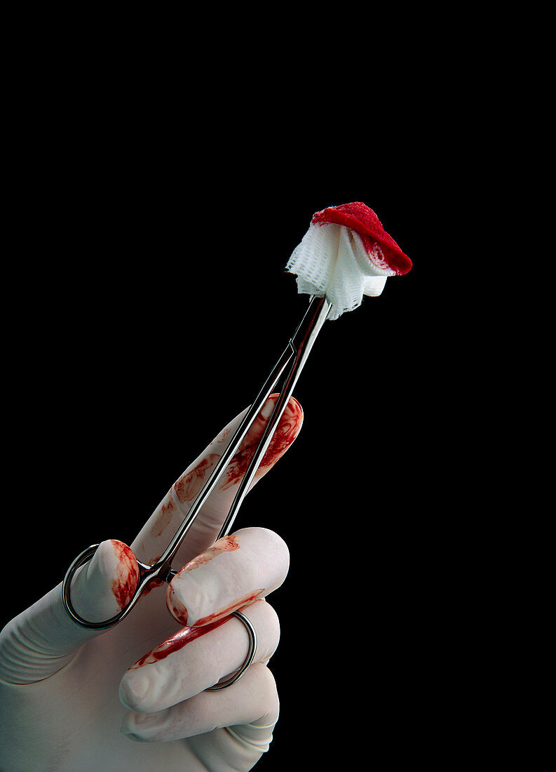 Blood-stained gauze held in scissor forceps