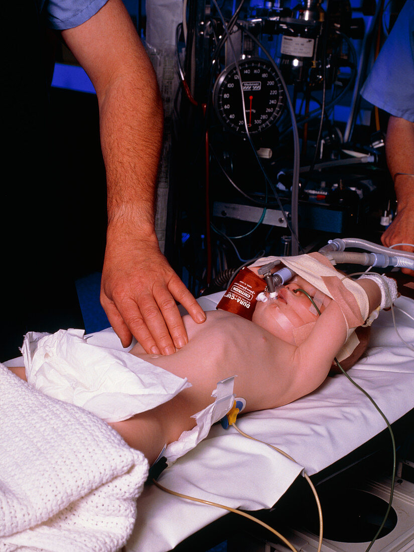 Infant having anaesthetic pre cardiac catheter