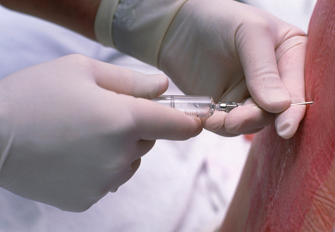 Doctor administering an epidural anaesthetic