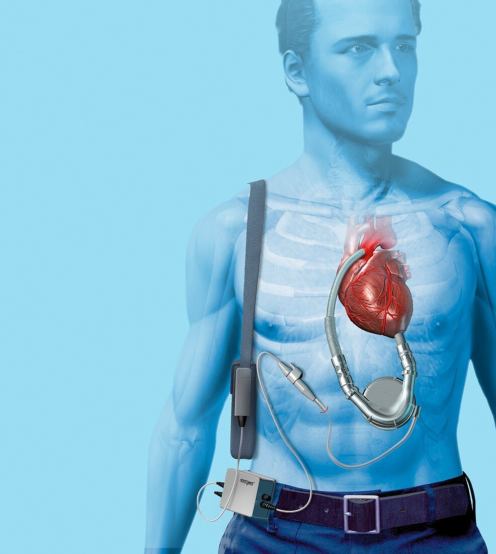 Mechanical heart pump,artwork