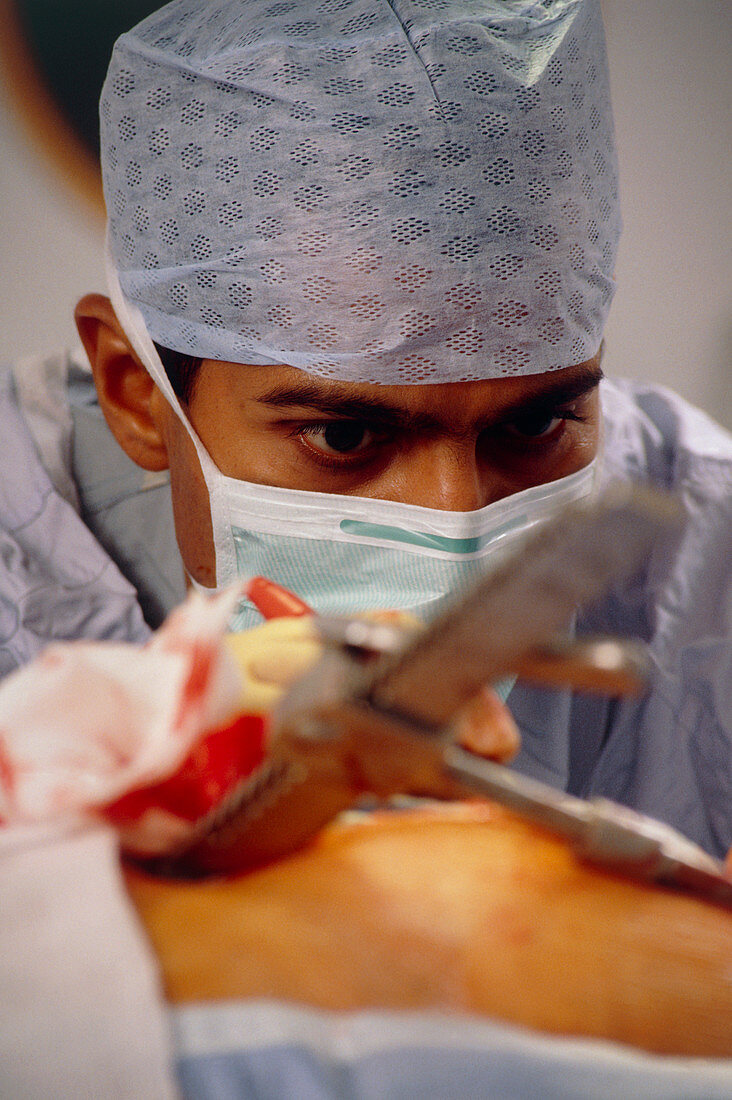 Surgeon during a quadruple bypass heart operation