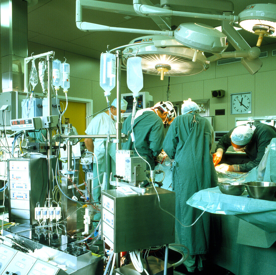 Surgery team conducting open heart surgery