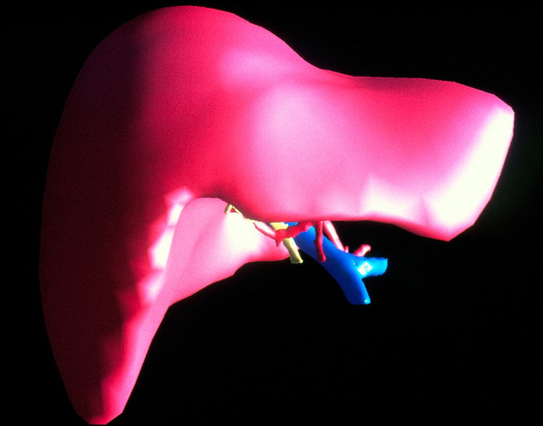 3-D image of human liver for virtual liver surgery