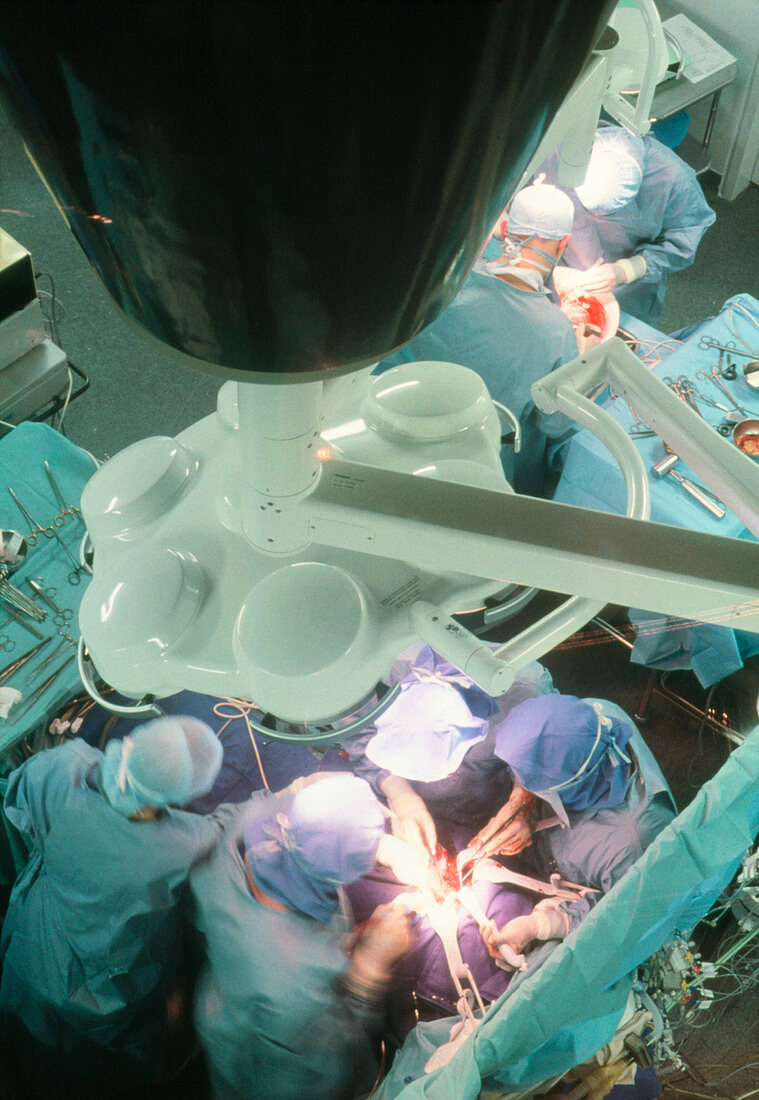 Liver transplant operation