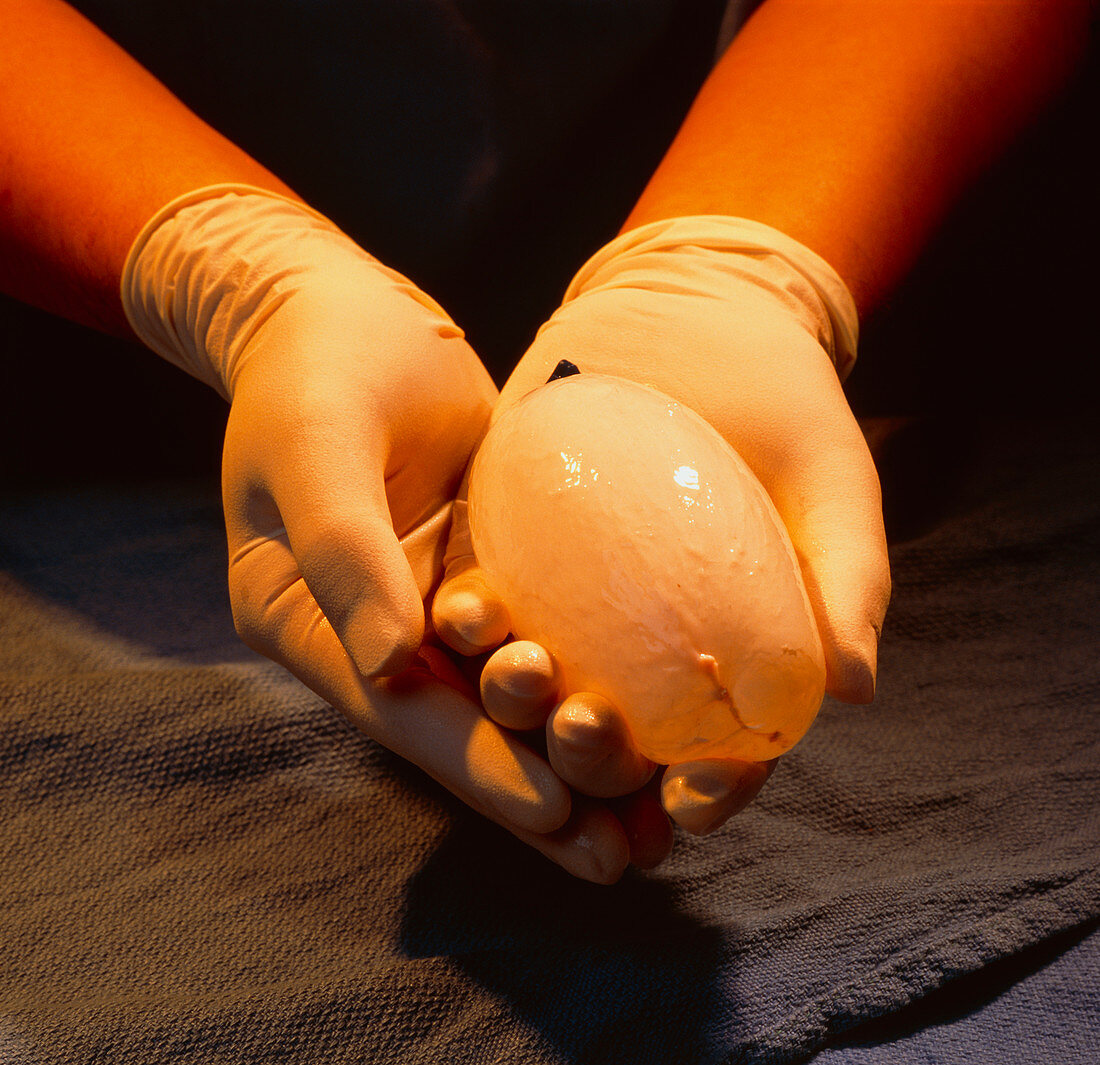 Artificial bladder being held in gloved hands