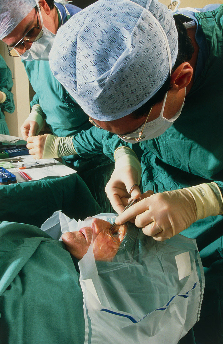 Cataract surgery: surgeon prepares patient's eye