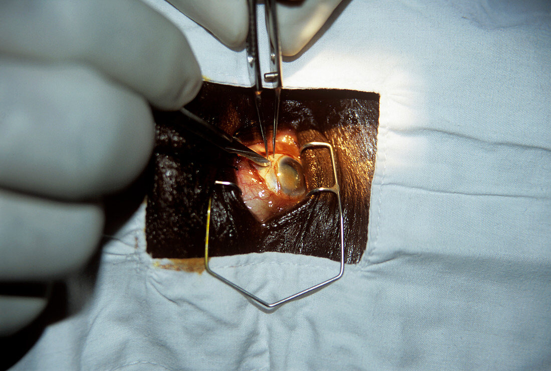 Cataract surgery,Kenya