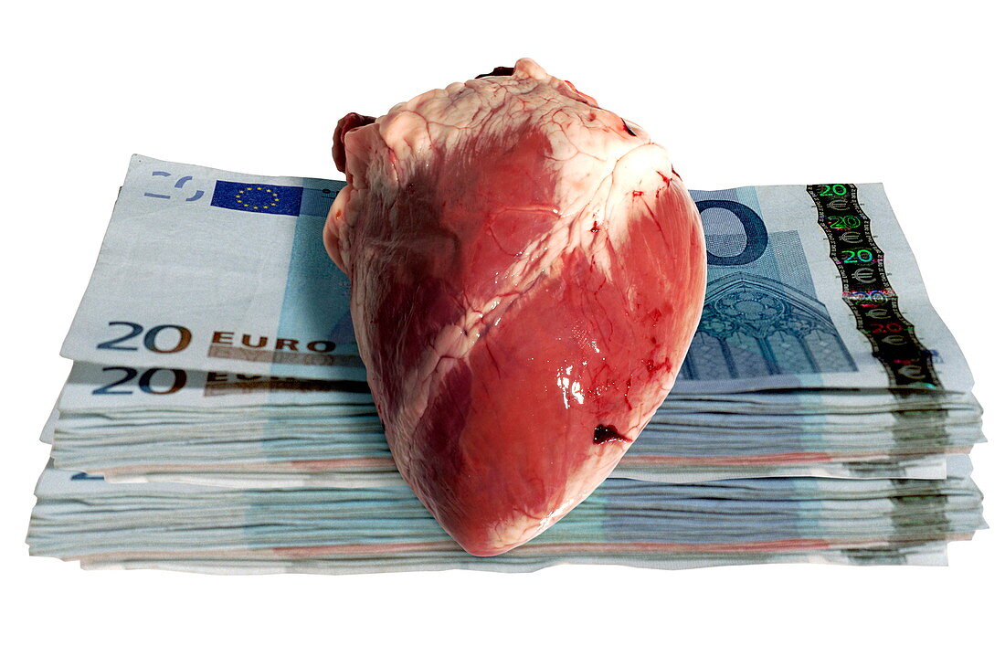 Heart transplant sale