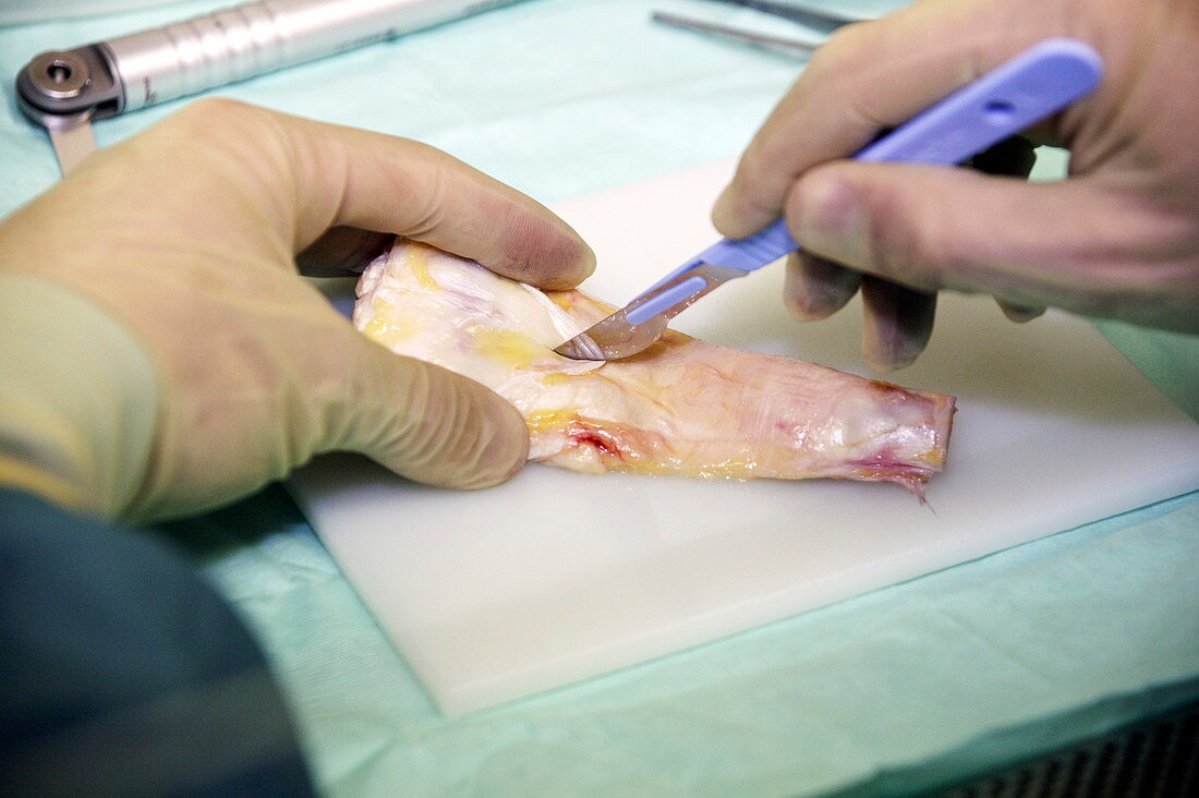 Dissection of a knee tendon
