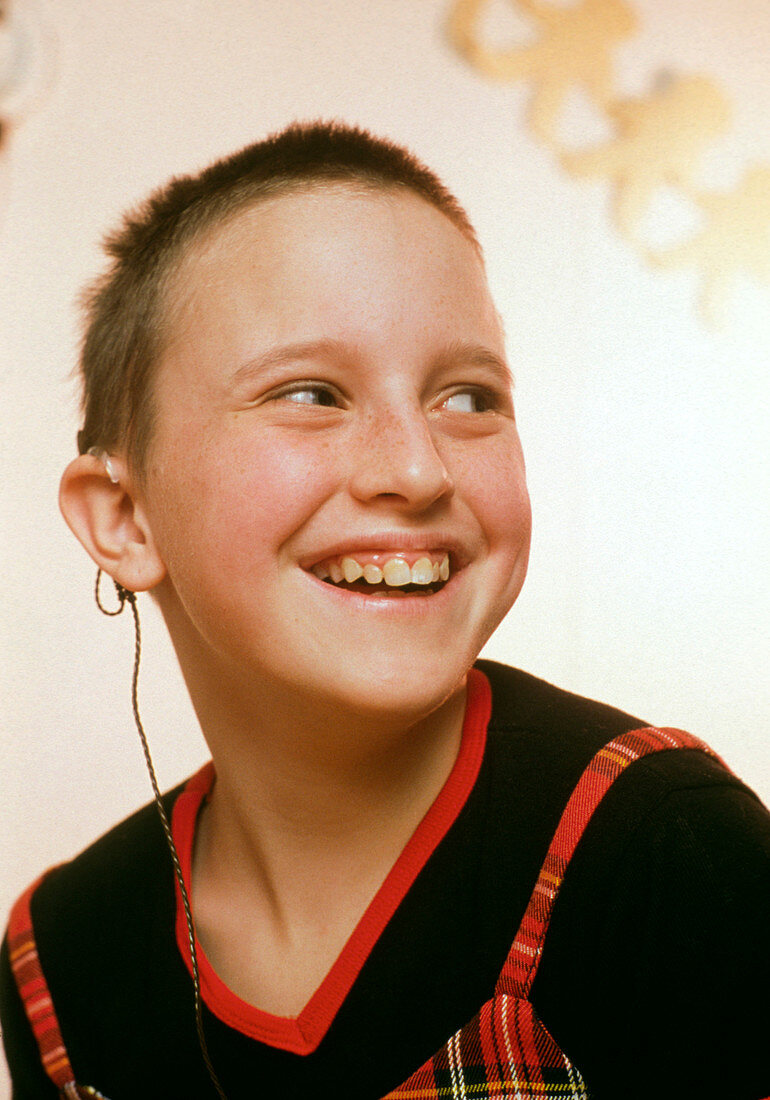 Young deaf girl wearing a cochlear implant device