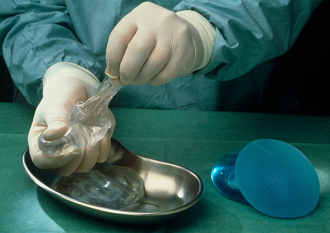 Gloved hands pulling silicone from breast implant