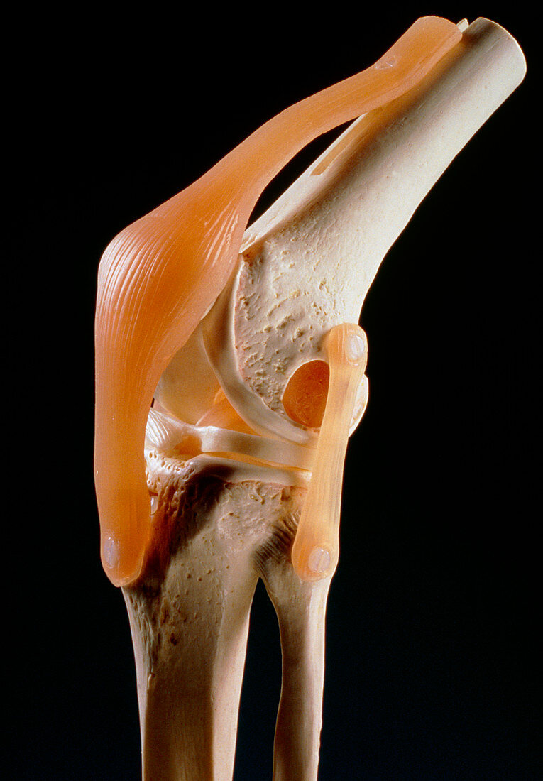 Artificial knee joint