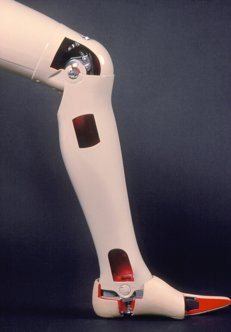 Artificial leg