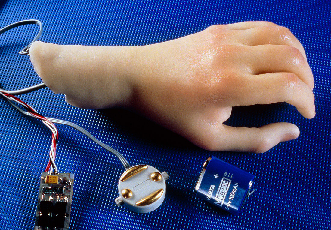Artificial hand with myelectric control system