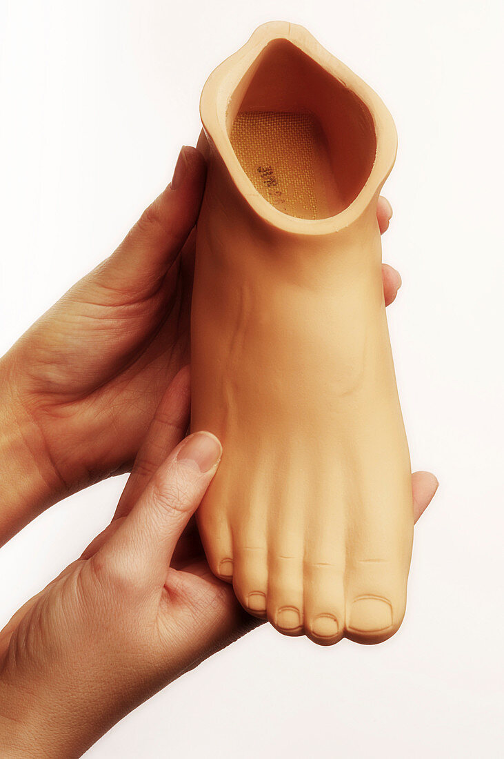 Prosthetic foot