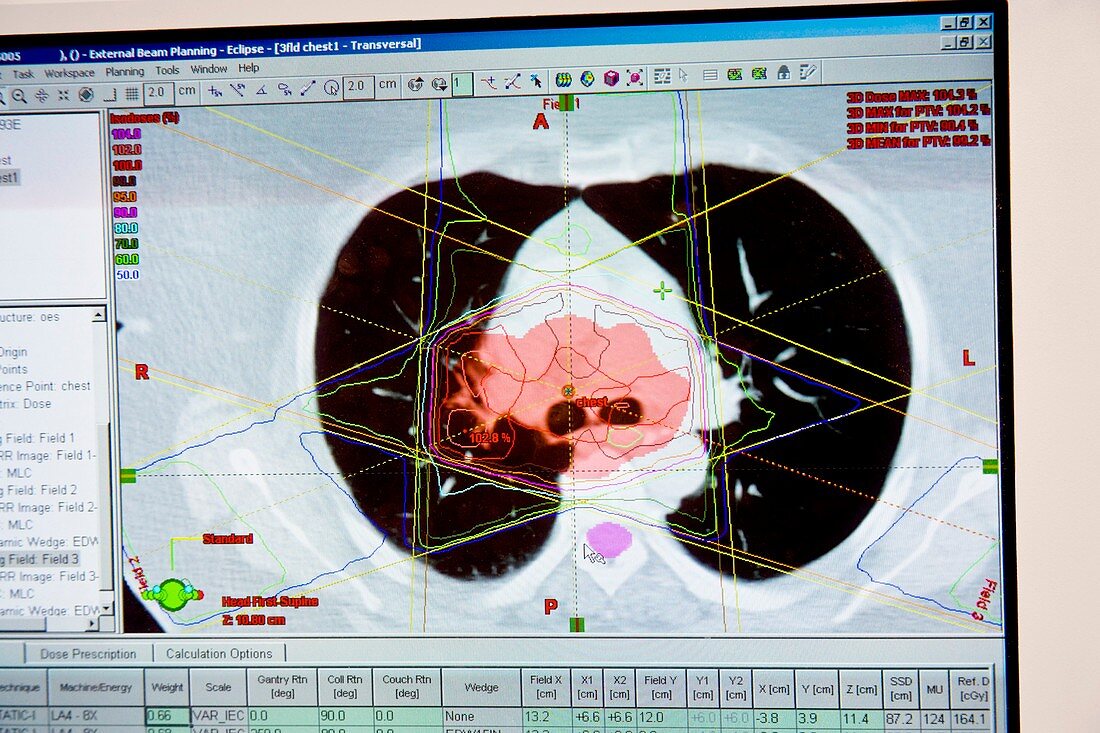 Cancer treatment plan,screenshot