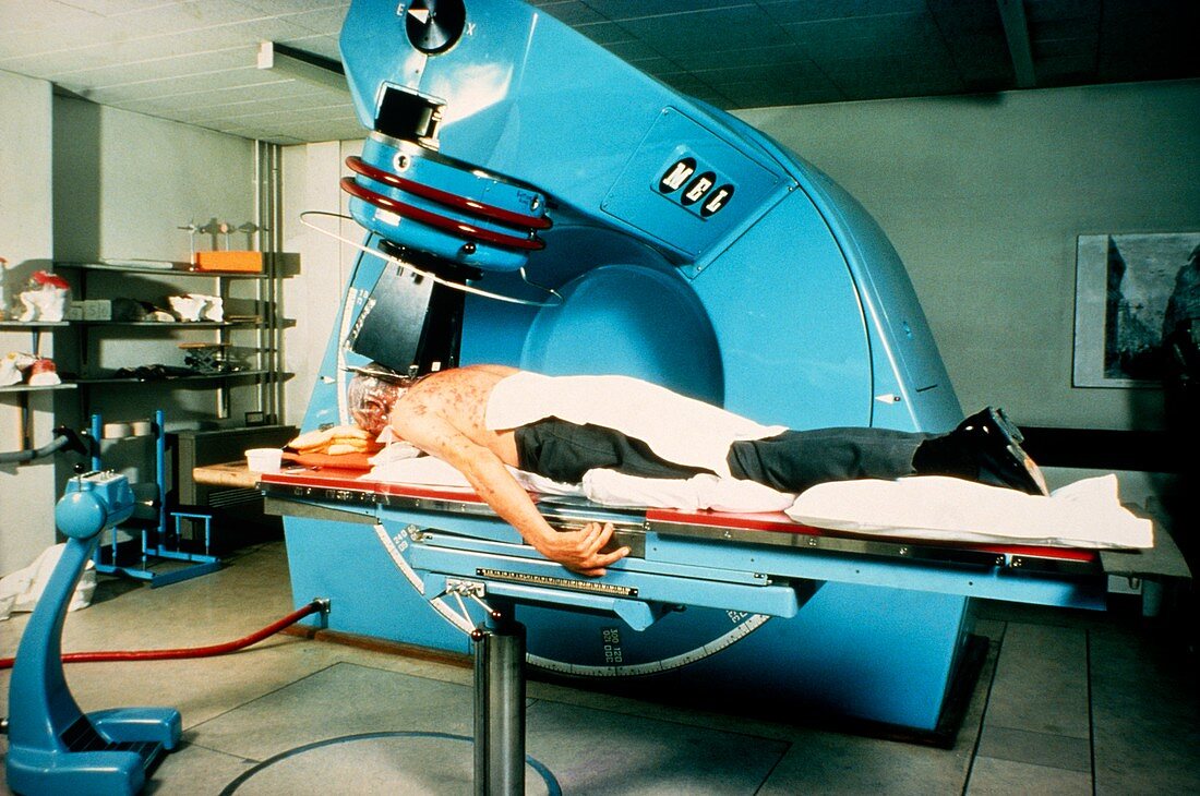 Radiation treatment for cancer