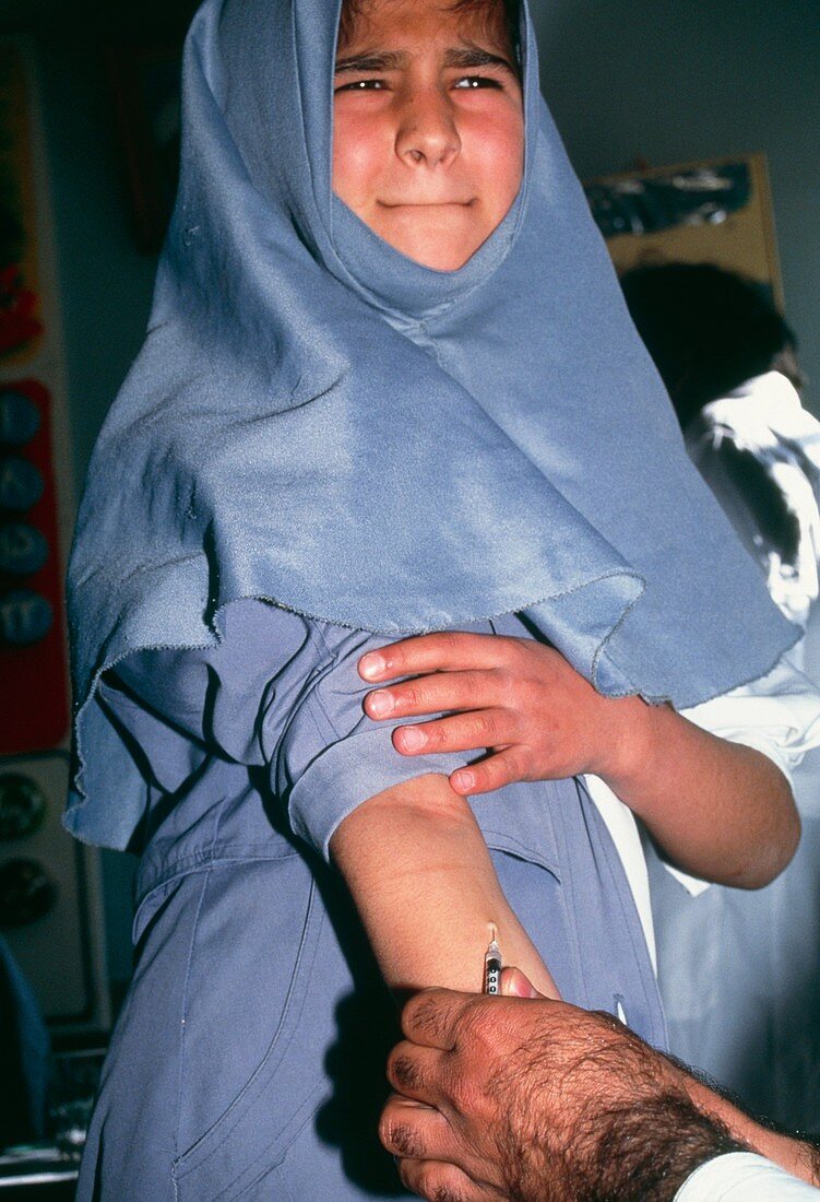 Girl undergoing a leishmanin skin test (LST)