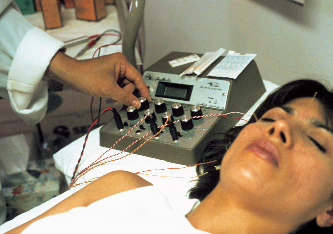 Face electro-acupuncture
