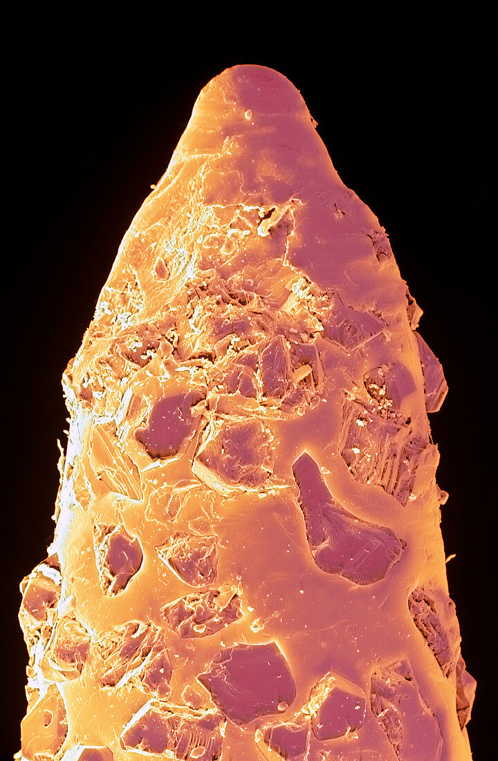 Coloured SEM of a diamond-tipped dental drill