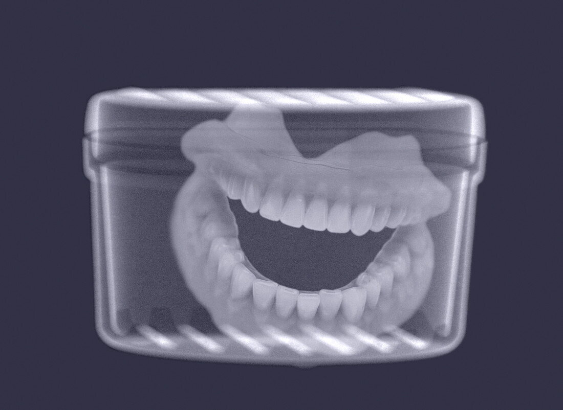 False teeth X-ray