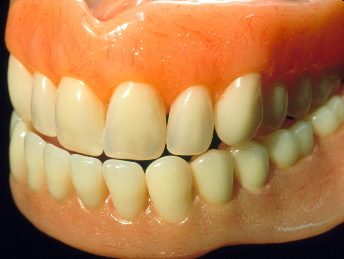 Close-up of a set of false teeth or dentures