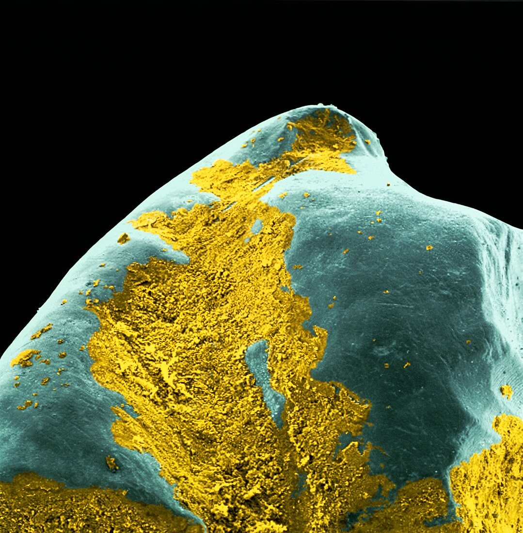 Coloured SEM of dental plaque seen on a t