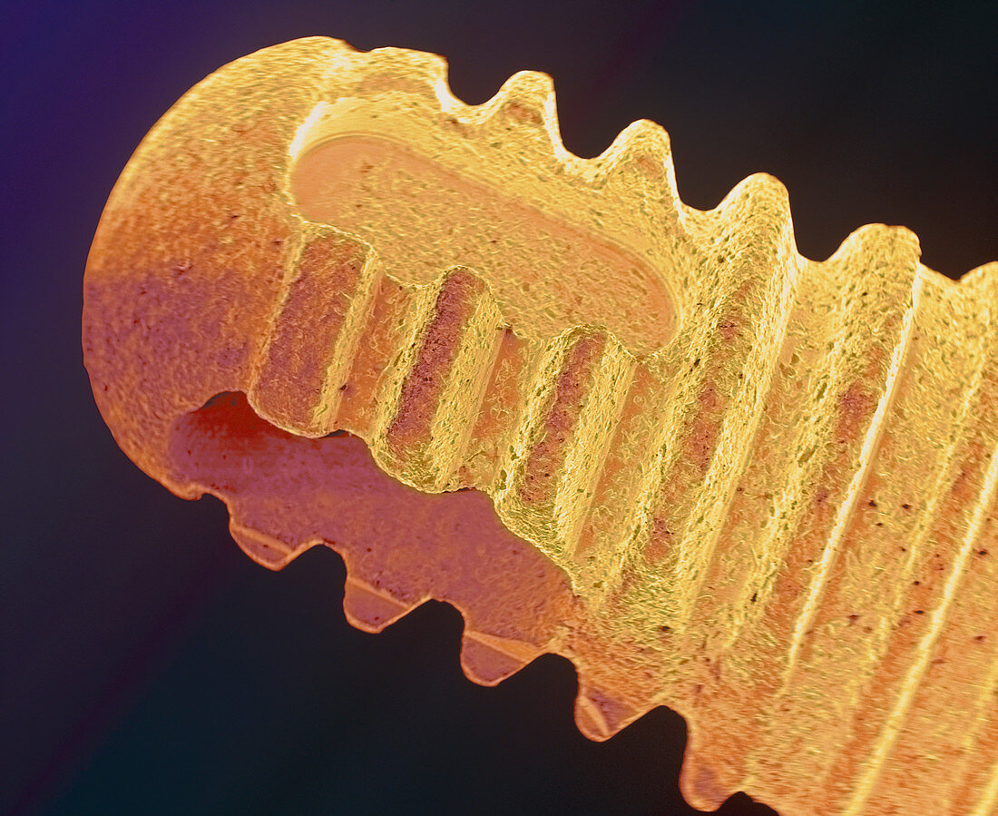 Coloured SEM of the root of a dental implant