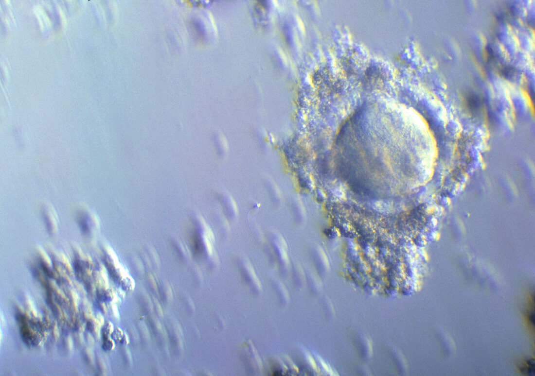 LM of a human egg cell during preparation for IVF