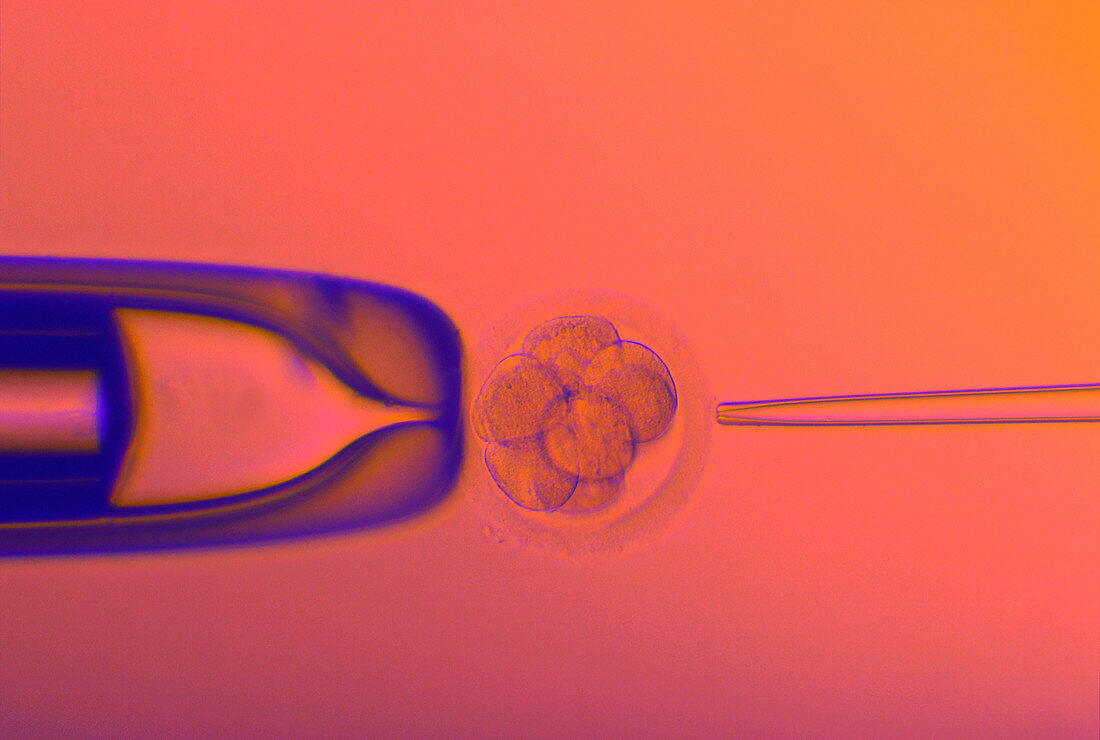 IVF embryo testing