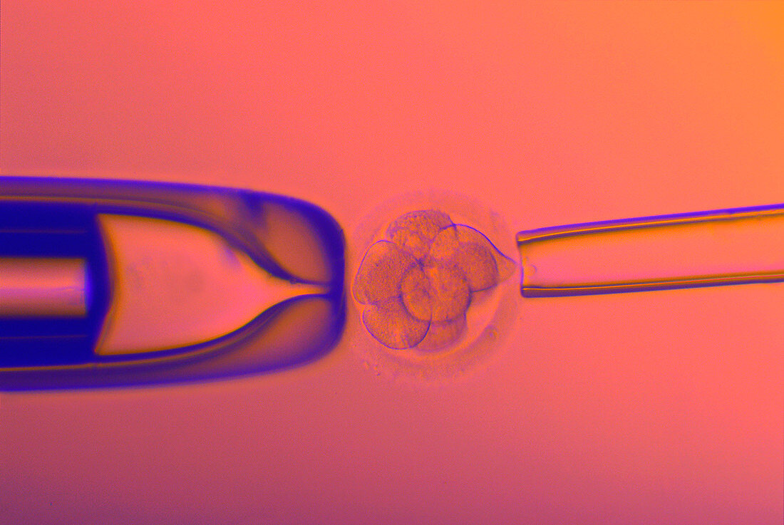 IVF embryo testing