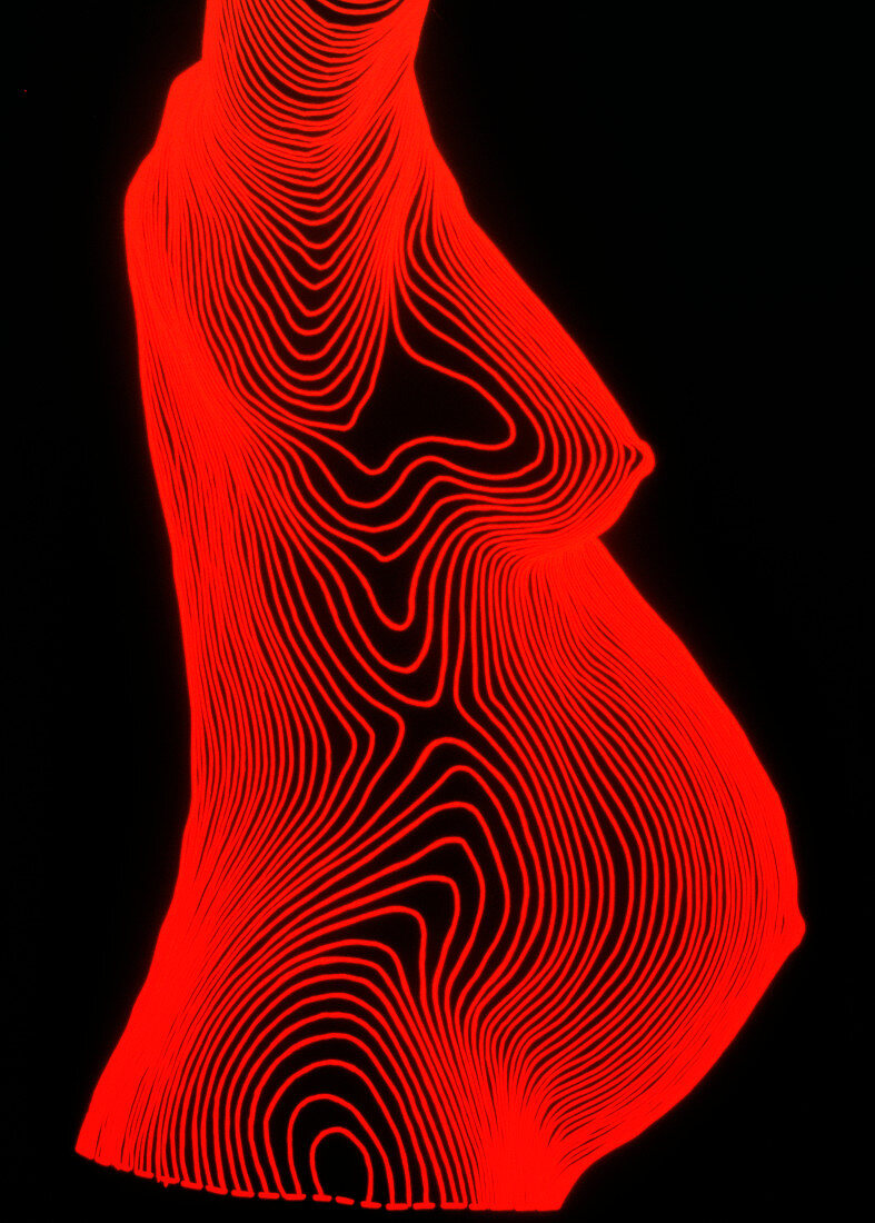 Body contour map of full term pregnant woman