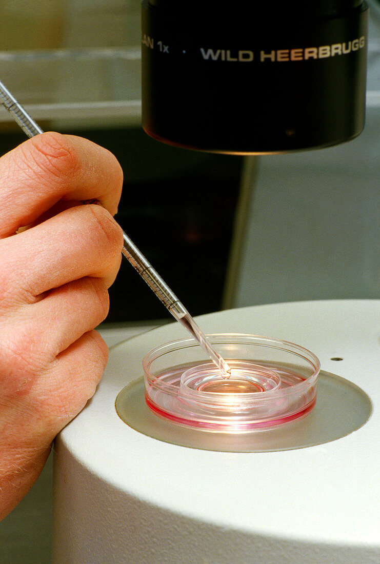 In vitro fertilisation (IVF) being performed