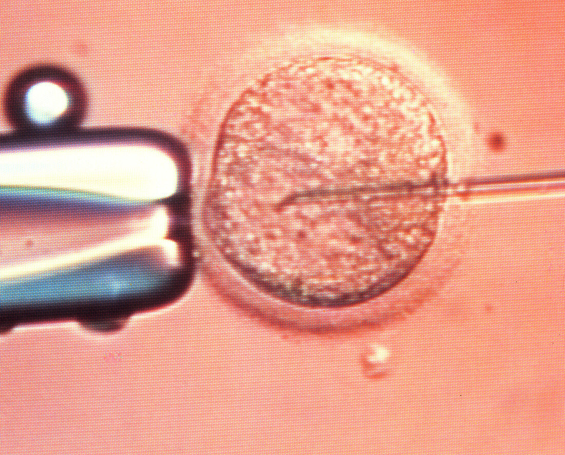 ICSI technique: egg injected with sperm