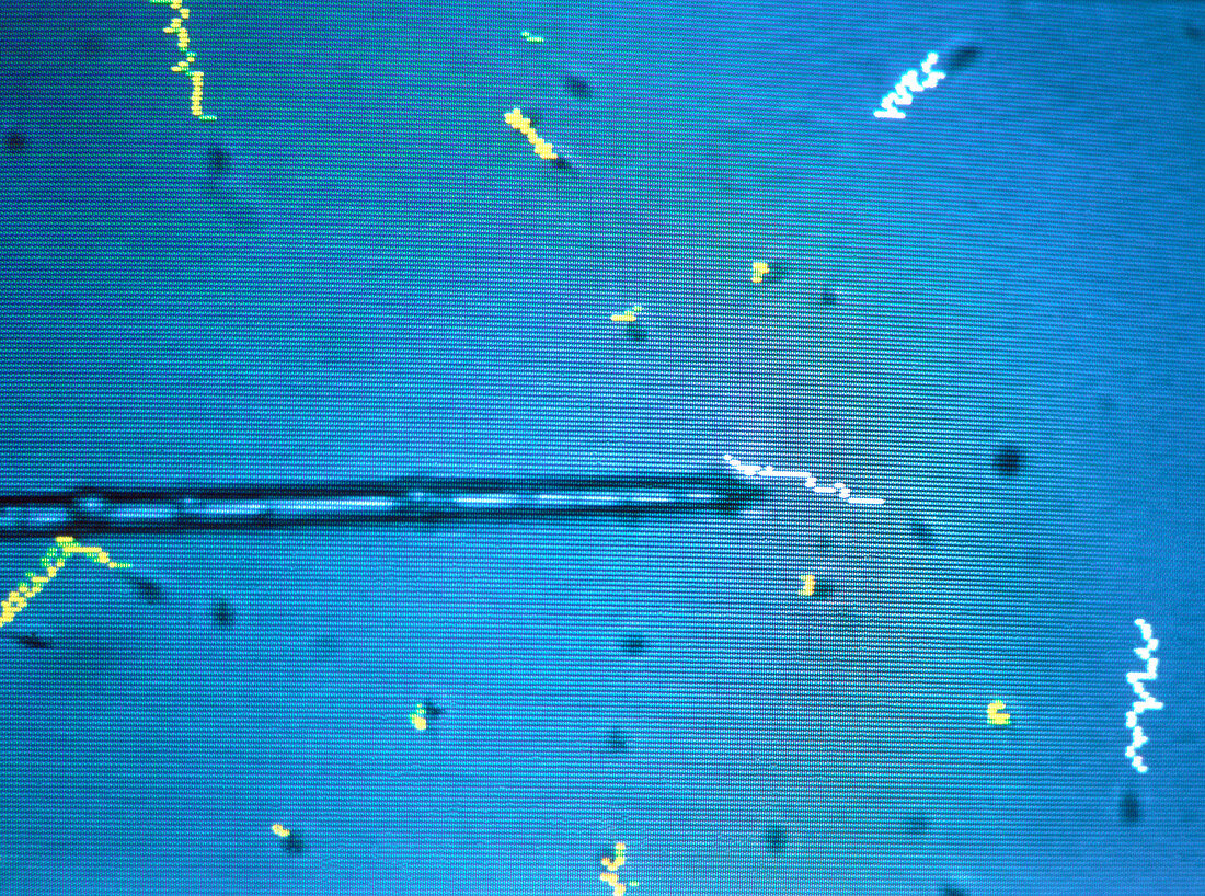 Computer Imaging Sperm Selection (CISS)