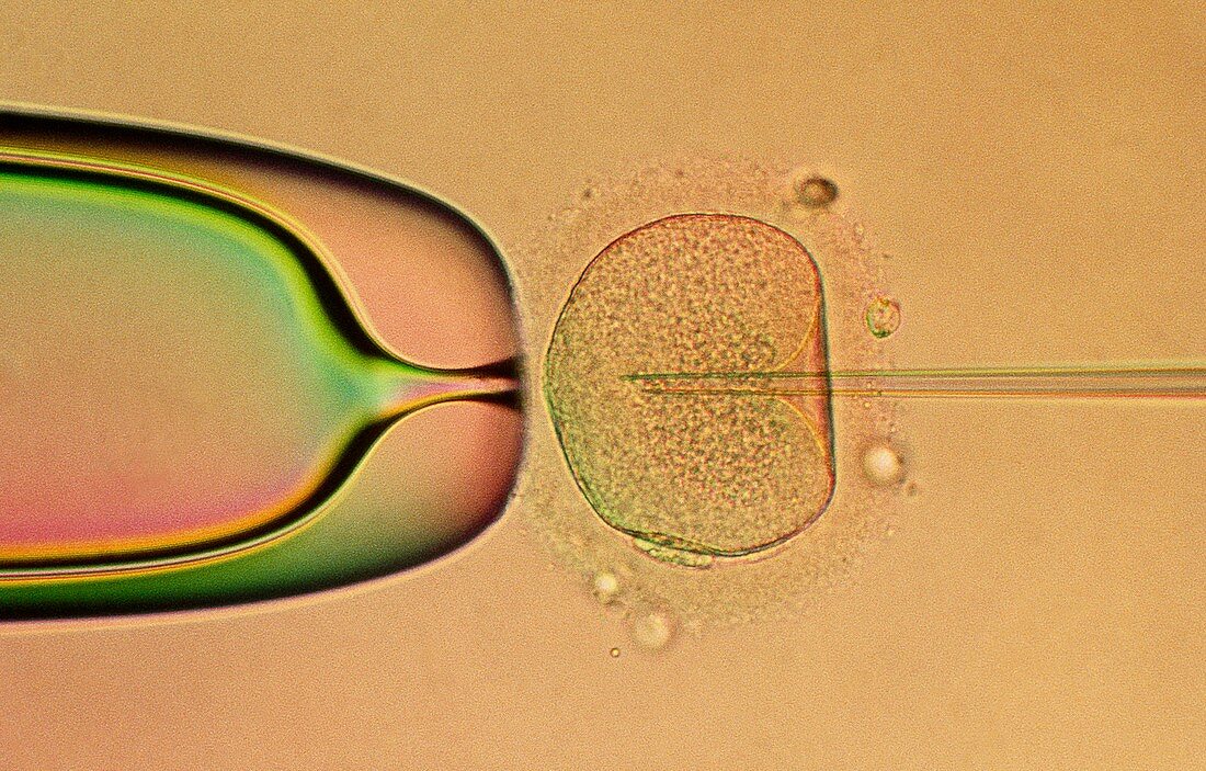 IVF: egg being injected with sperm DNA