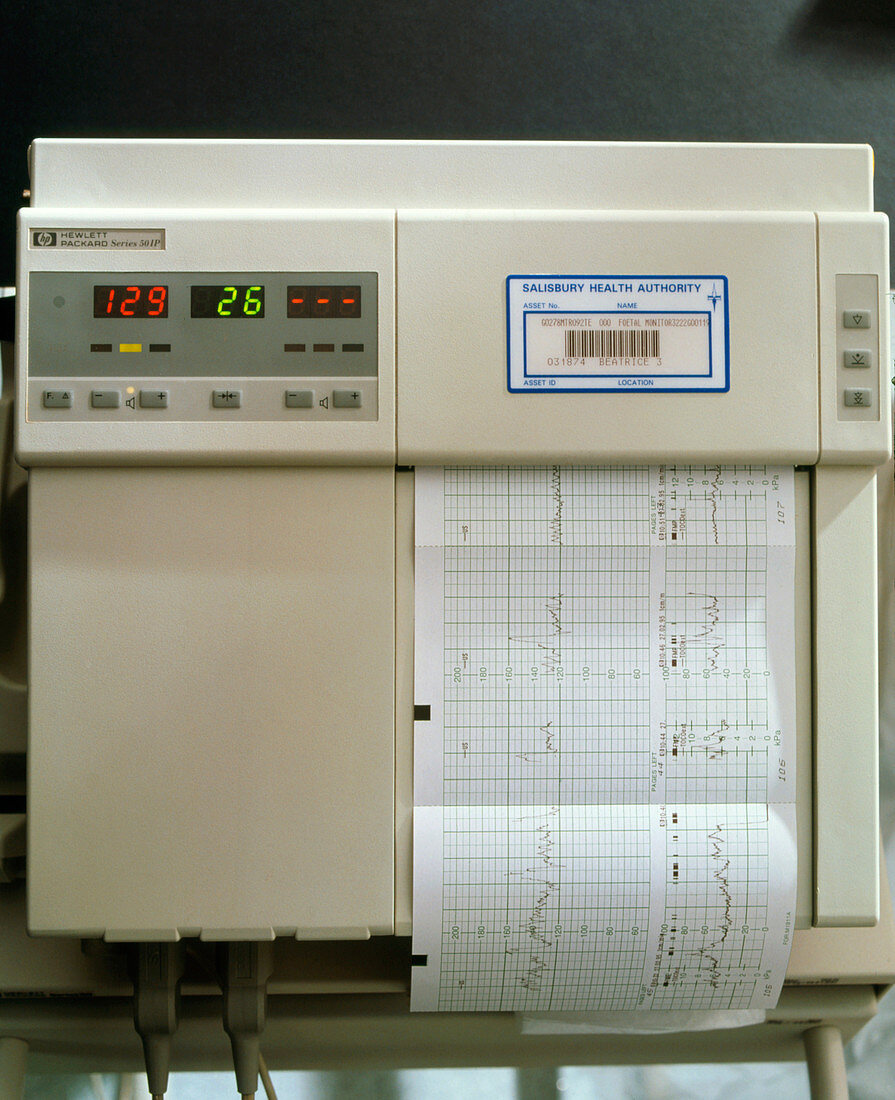 View of a foetal cardiotocography (CTG) machine