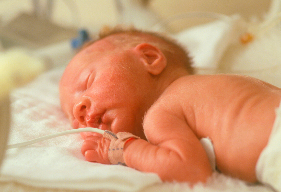 A premature baby in a special care unit