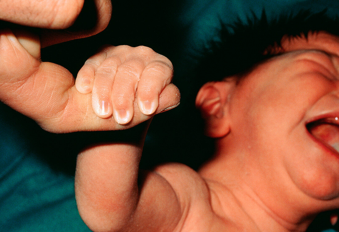 Newborn baby reflex to cling on with hands