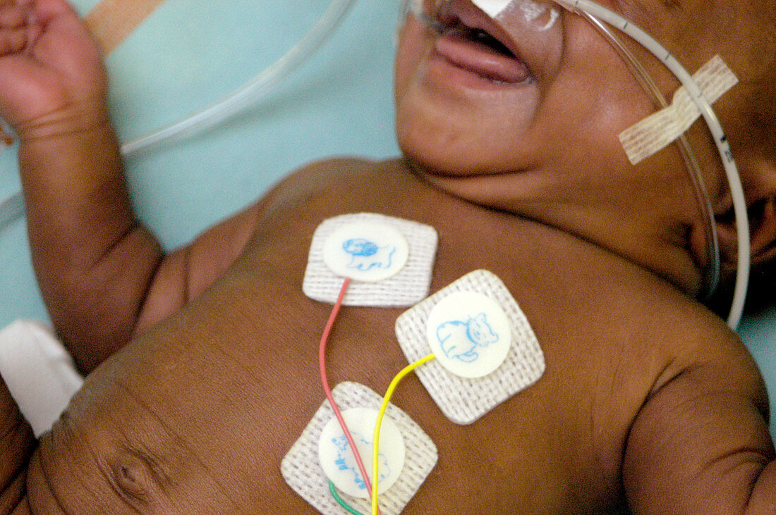 Premature baby monitoring