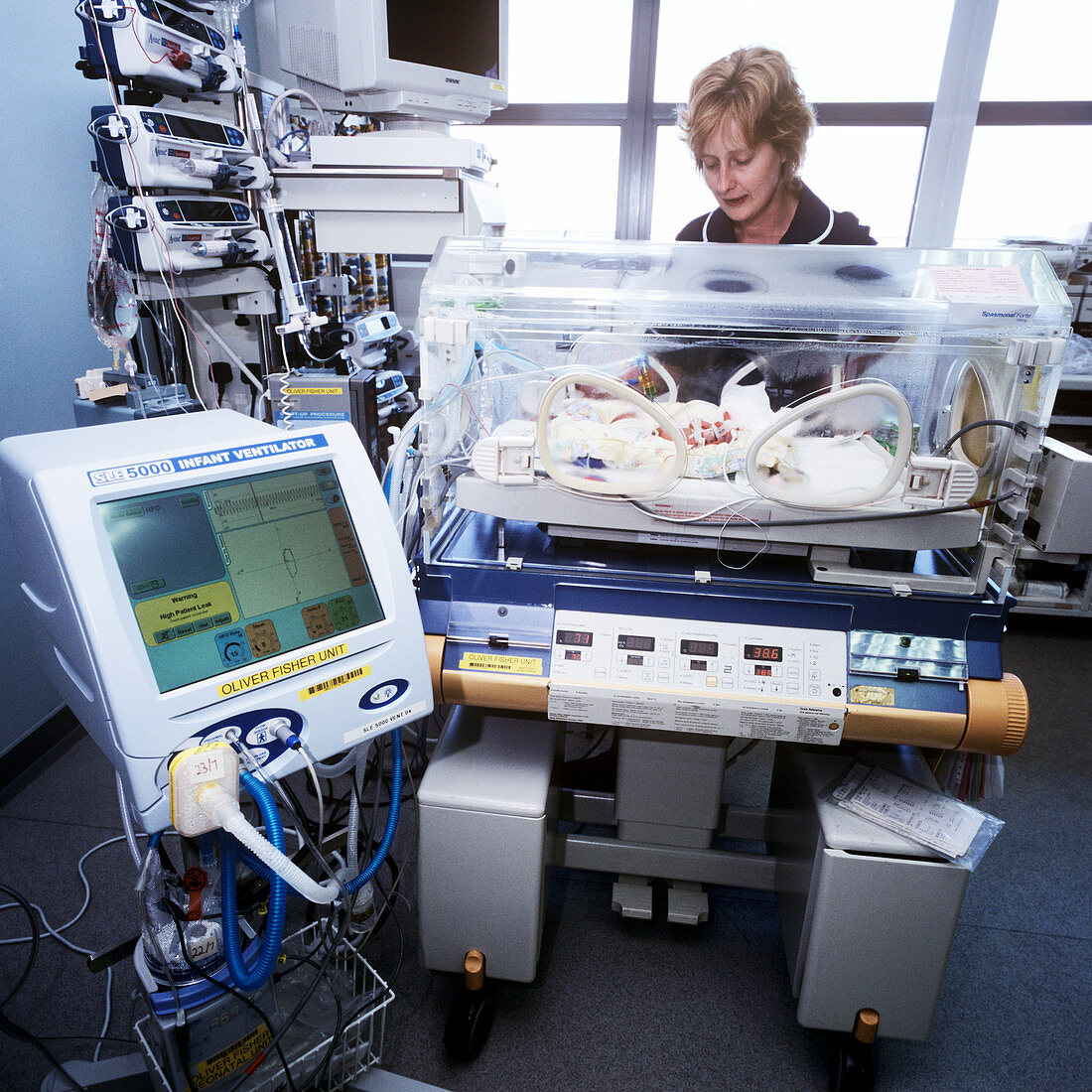 Ventilator for premature baby