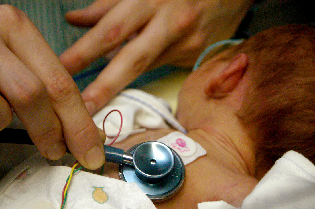 Doctor examining a premature baby