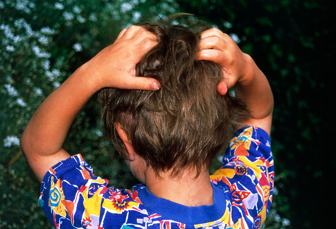 Head lice: 3-year-old boy scratches his head