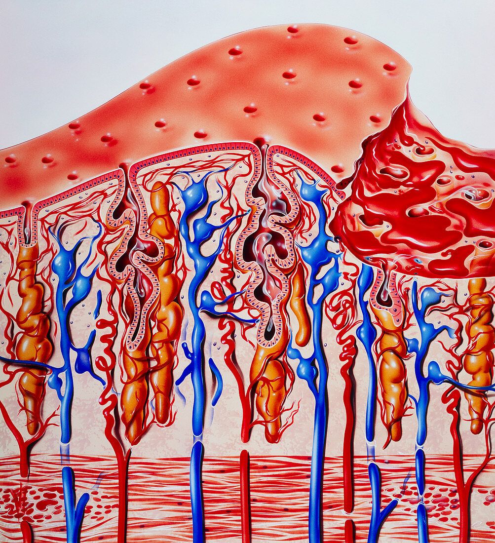 Illustration of the uterus during menstruation