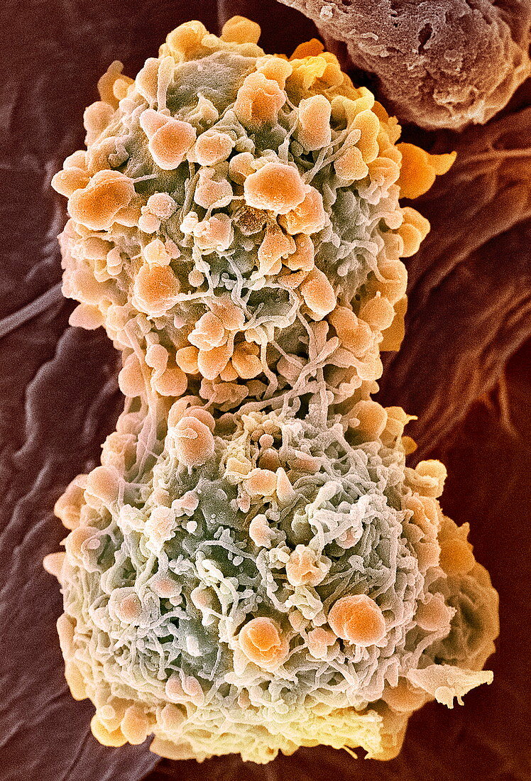 Cervical cancer cells dividing,SEM