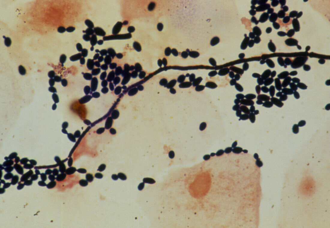 LM of candida albicans,found in vaginal smear