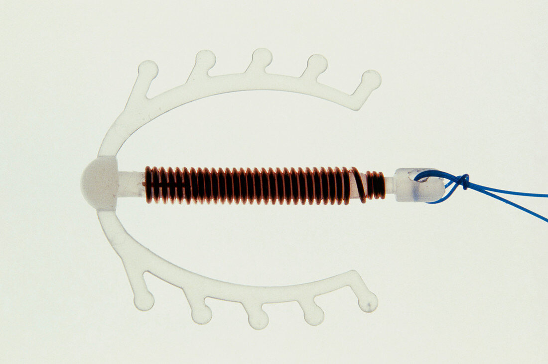 Intrauterine contraceptive device